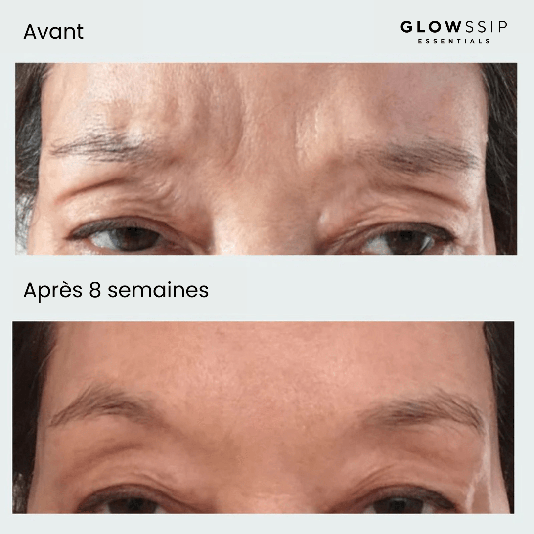 Masque Yeux Anti-Âge