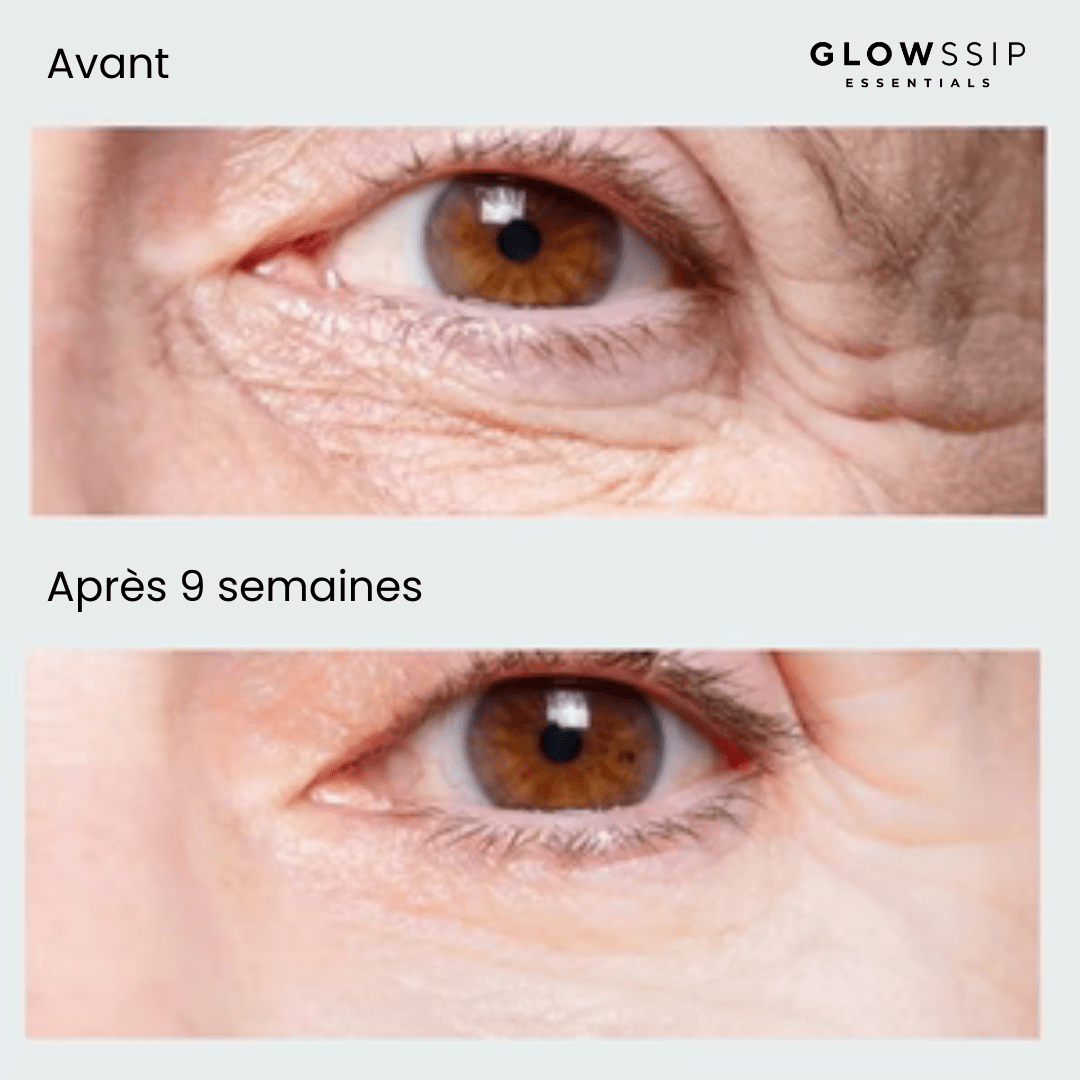 Masque Yeux Anti-Âge