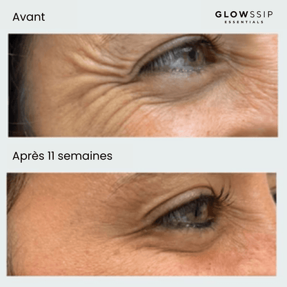 Masque Yeux Anti-Âge