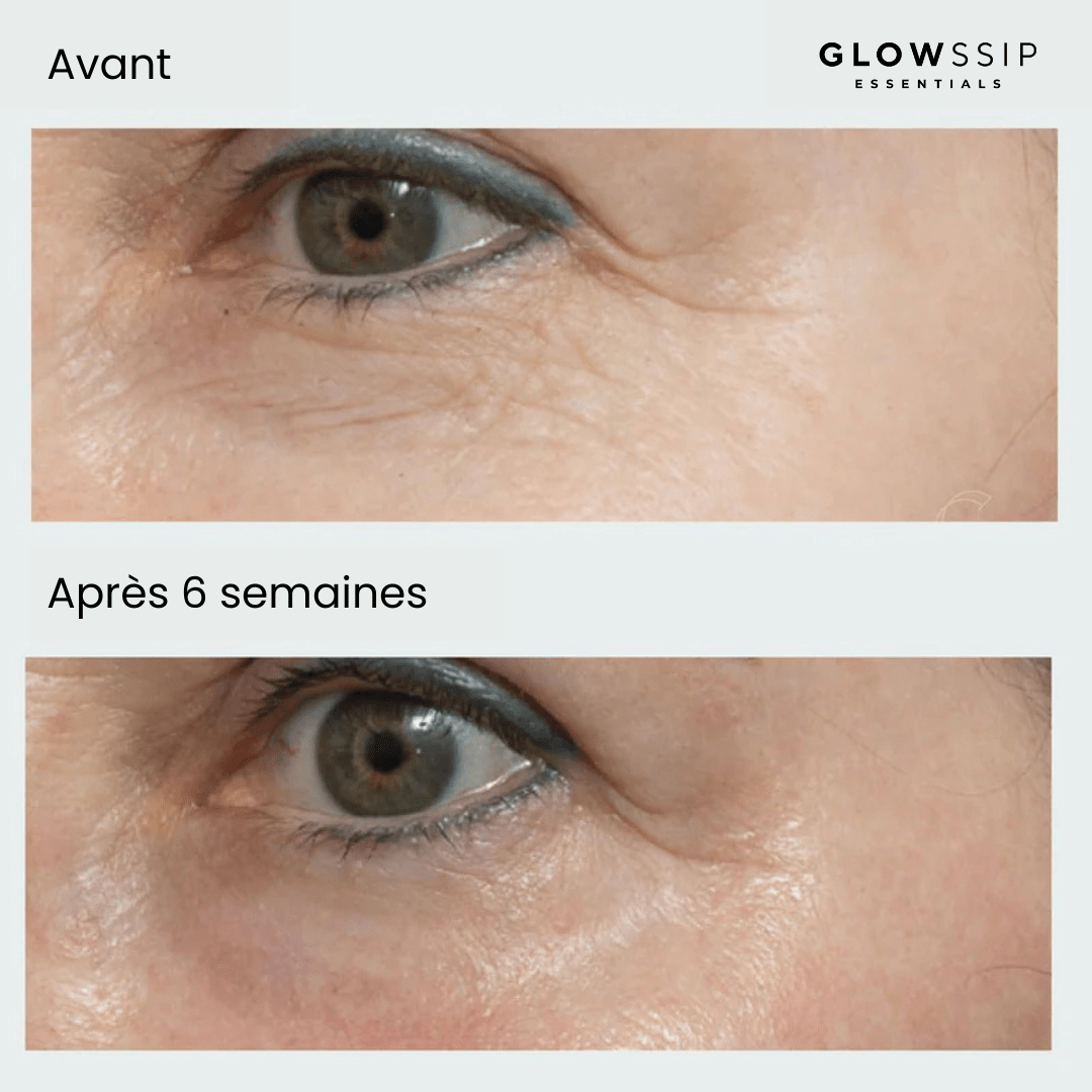 Masque Yeux Anti-Âge
