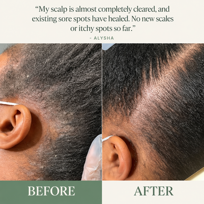 Korean Scalp Revival Bar