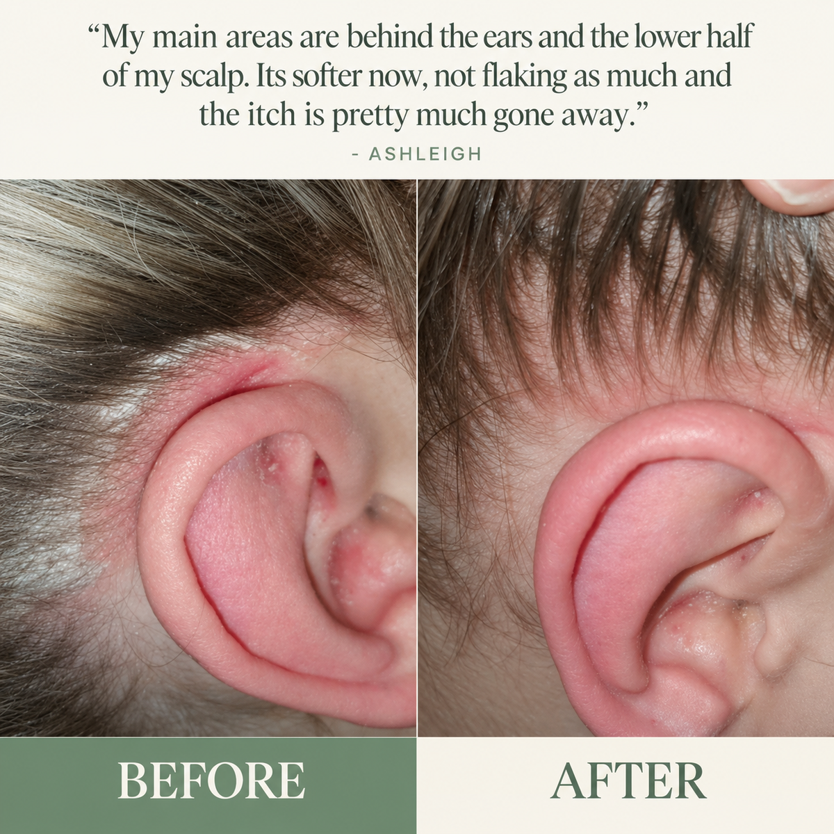 Korean Scalp Revival Bar